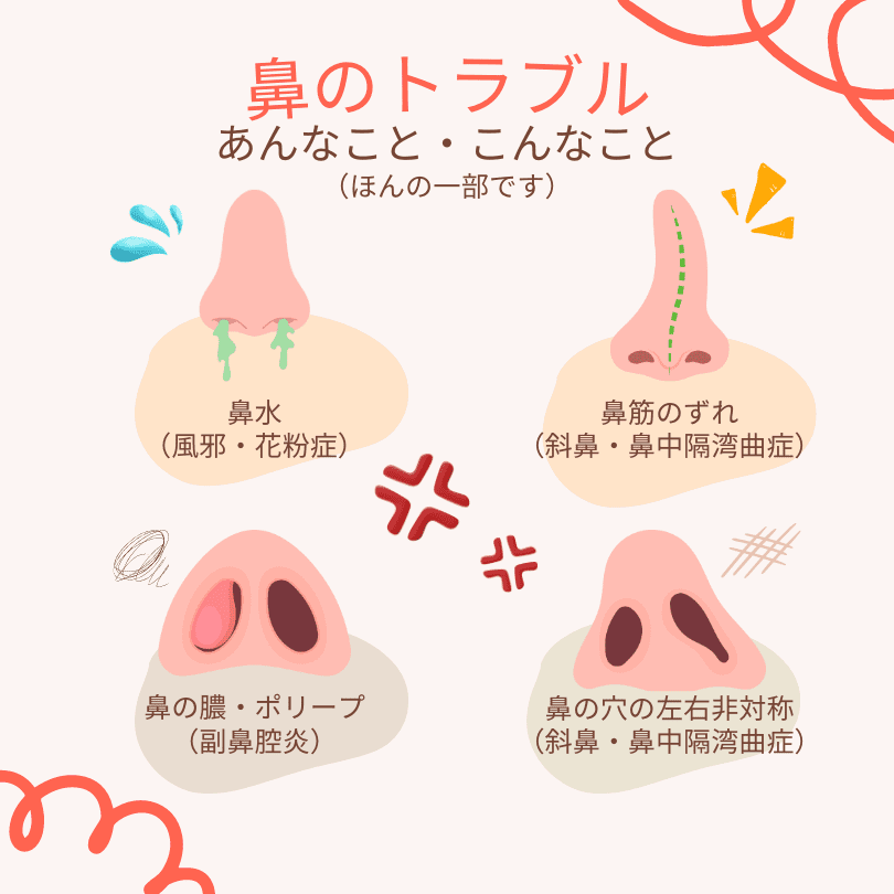 鼻のトラブル：あんなことこんなこと